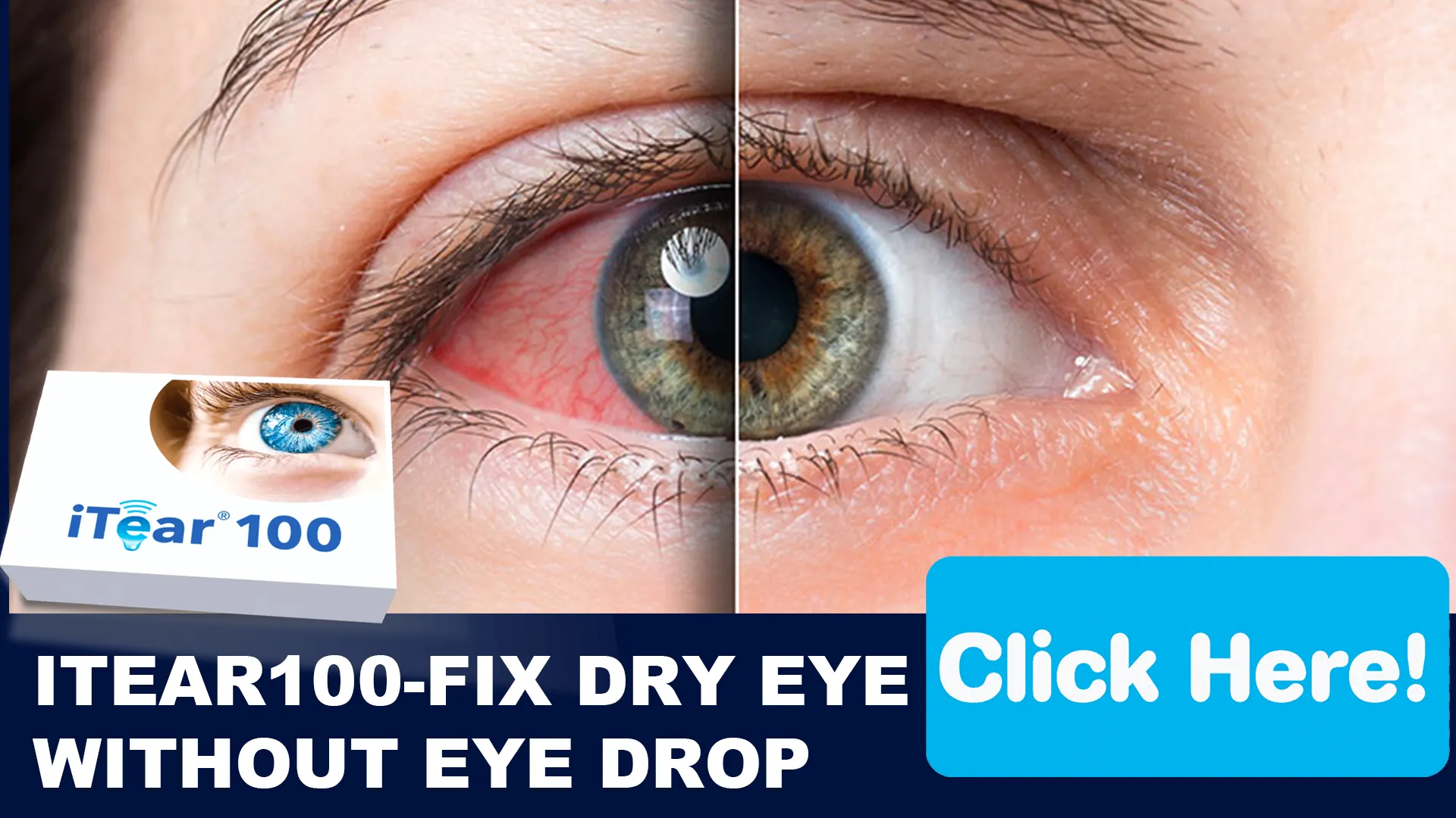 Complementary Therapies for Dry Eye Management